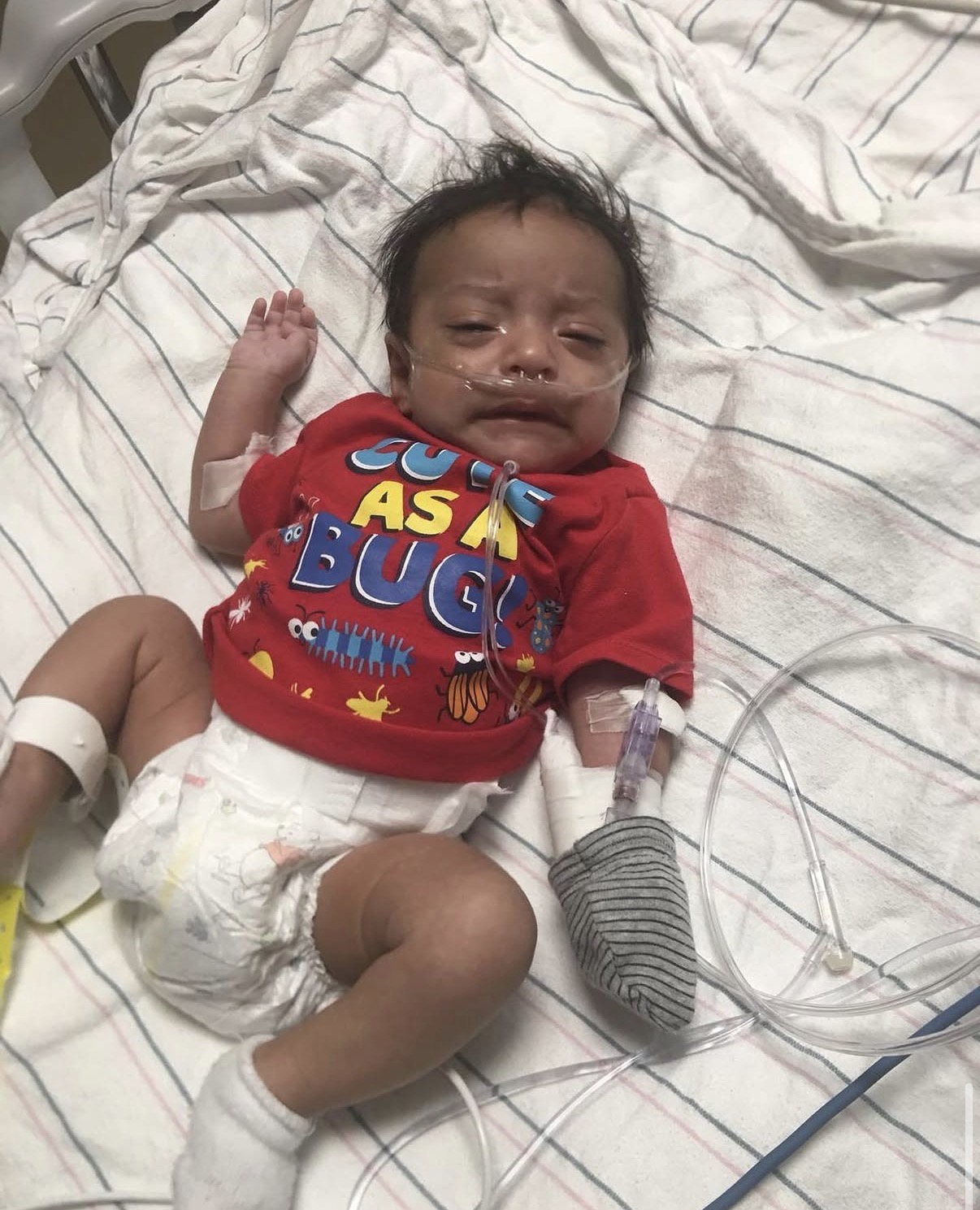 Infant lying on bed with medical IV in arm, wearing a red shirt and diaper, appearing distressed.